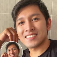 Dionnel